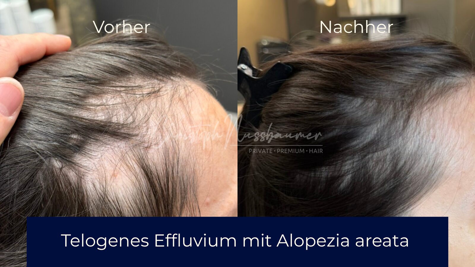 Vorher-Nachher Ergebnis 1