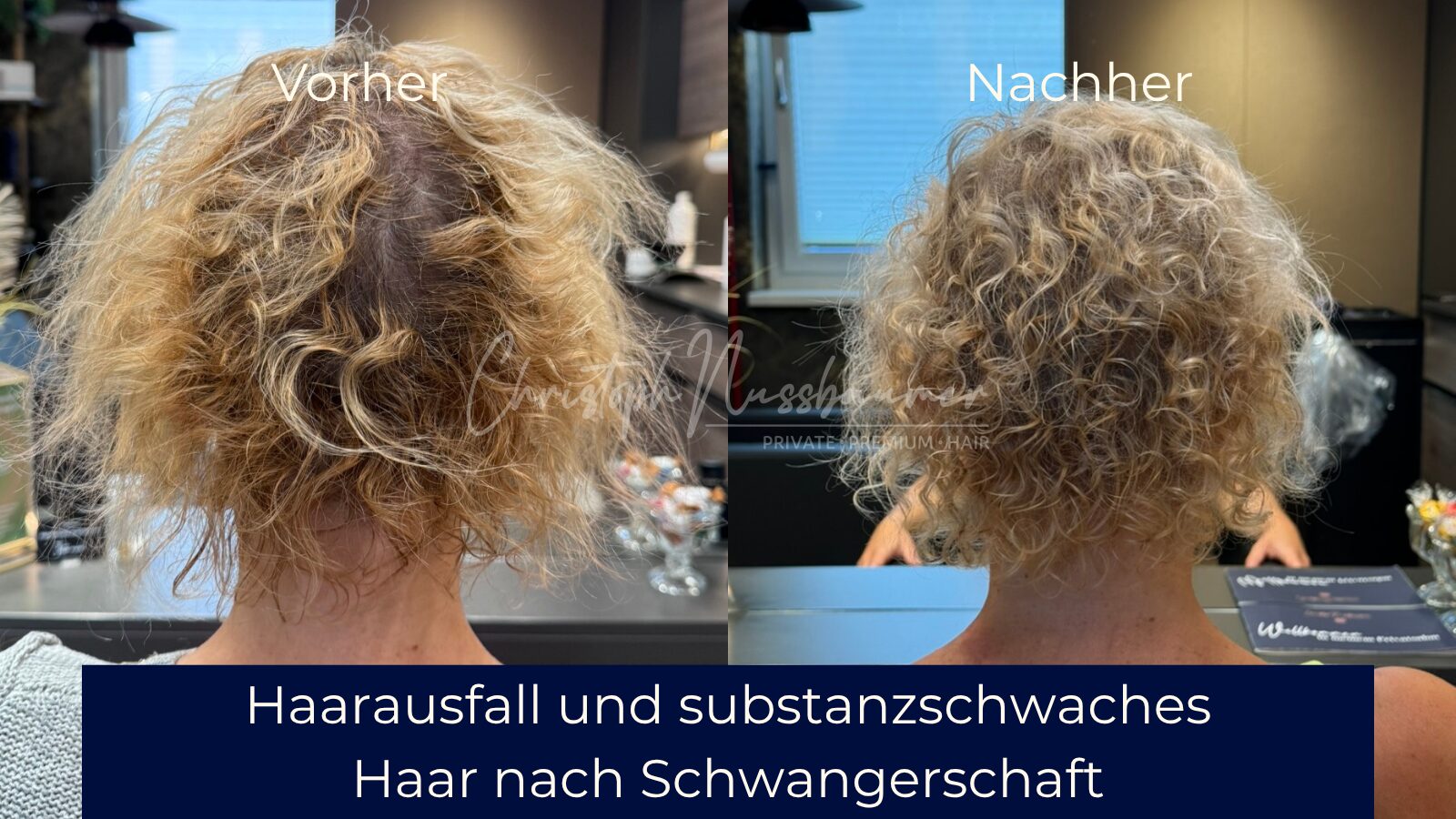 Vorher-Nachher Ergebnis 2