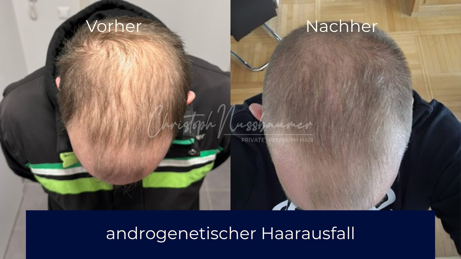 Vorher-Nachher Ergebnis 3